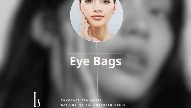 Σακούλες κάτω από τα μάτια: Αιτίες & 8 Lifestyle Tips για πιο ξεκούραστο βλέμμα